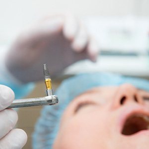 A patient getting dental implant surgery